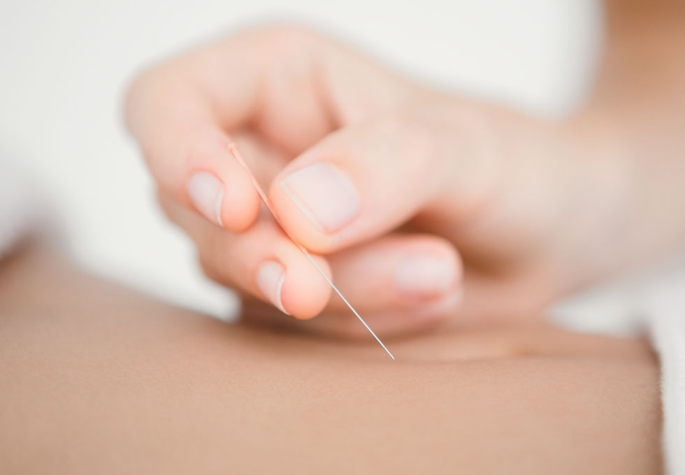 Akupunktur Freilassing